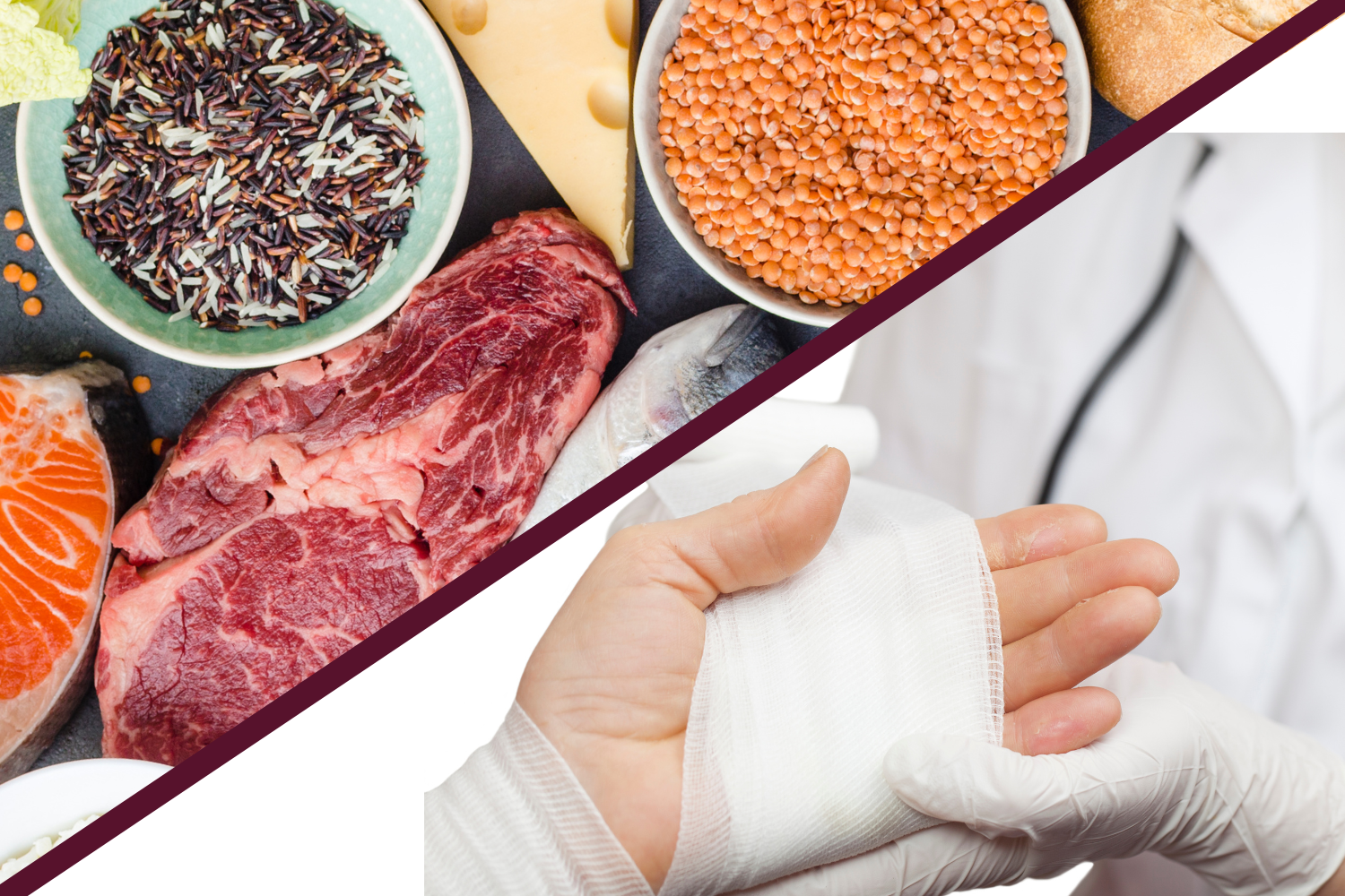 Healthy protein and grains next to a person having a wound bandaged on their hand.